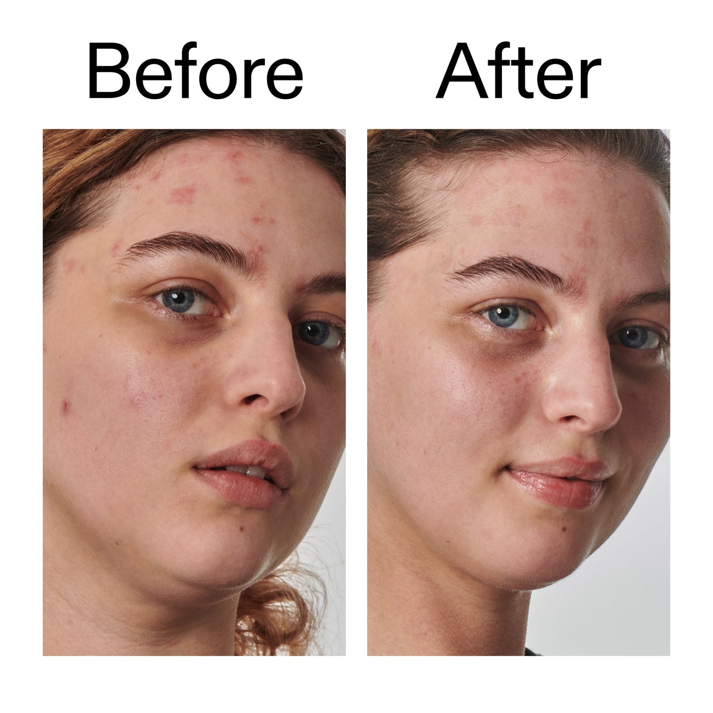 10-urea-moisturizer-b3 Dry_and_Rough_Skin_Solution_Before_After_2000x2000_efa6e639-5c39-49bd-a5dd-f0220293120a.jpg