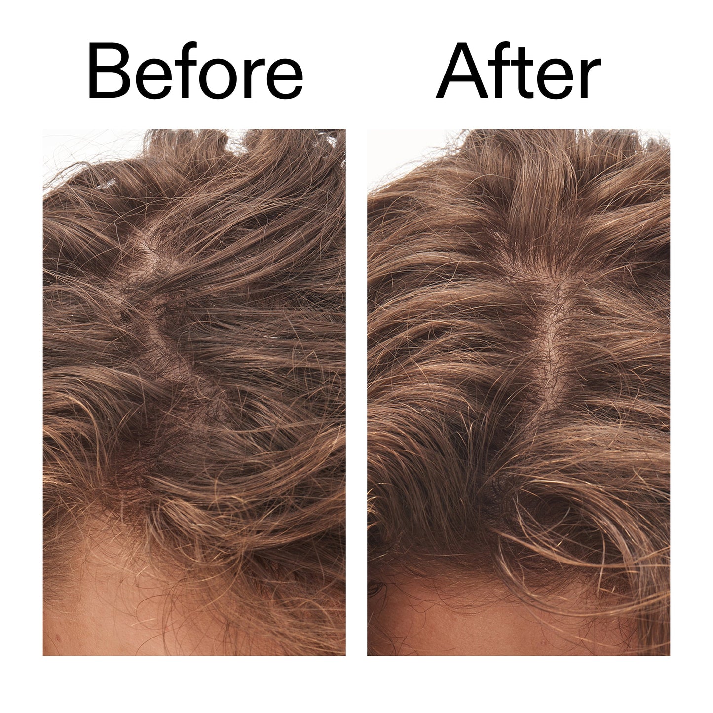 glycolic-acid-exfoliating-scalp-scrub-n9 Glycolic_Acid_Exfoliating_Scalp_Scrub_Before_After_2000x2000_b8561c87-05a1-4caa-80f7-1b6b33d750f7.jpg