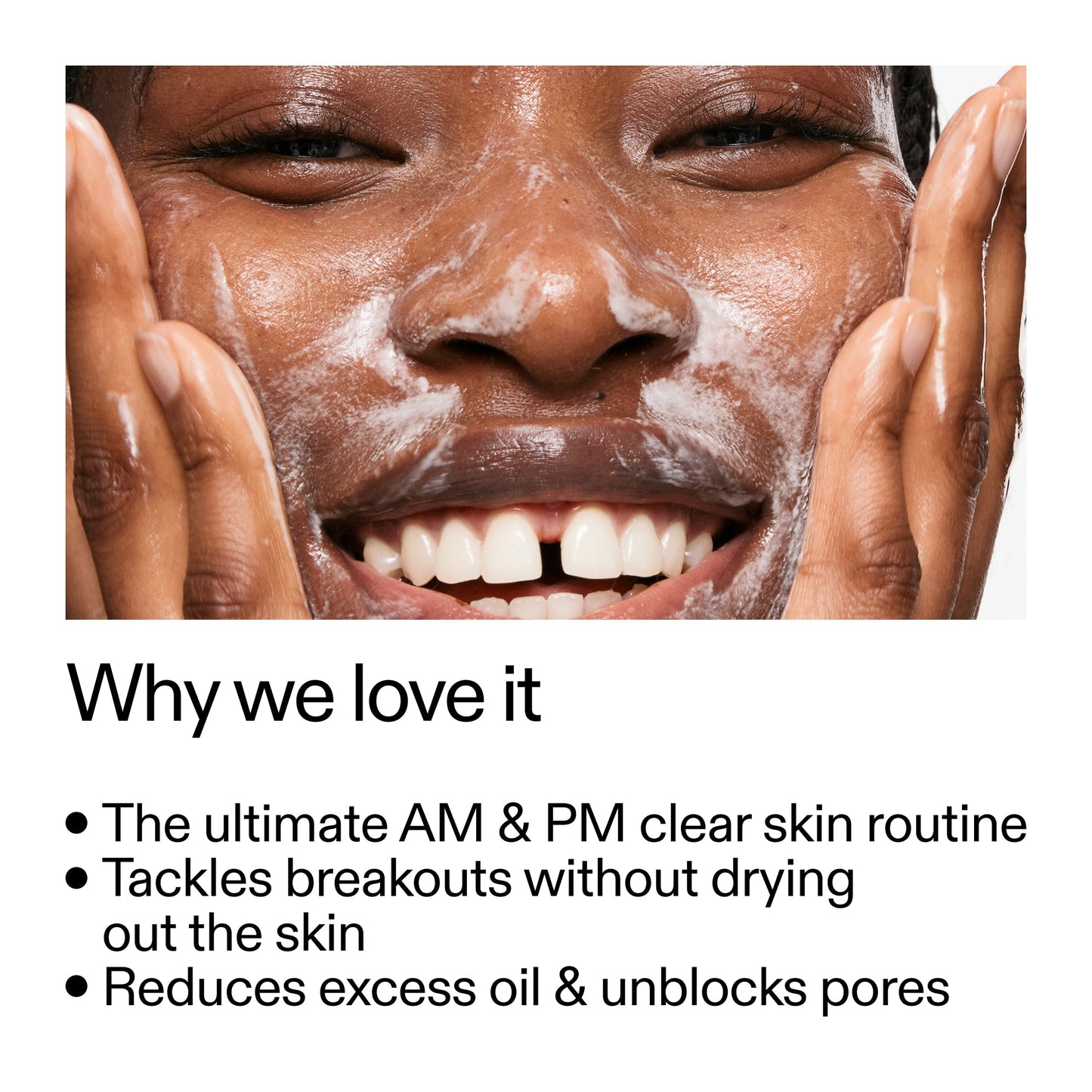 intro-routine-for-acne-n0 Intro_Routine_for_Acne_Why_we_love_it_2000x2000_42499e10-4629-4a0e-a627-7e215f4da6bc.jpg