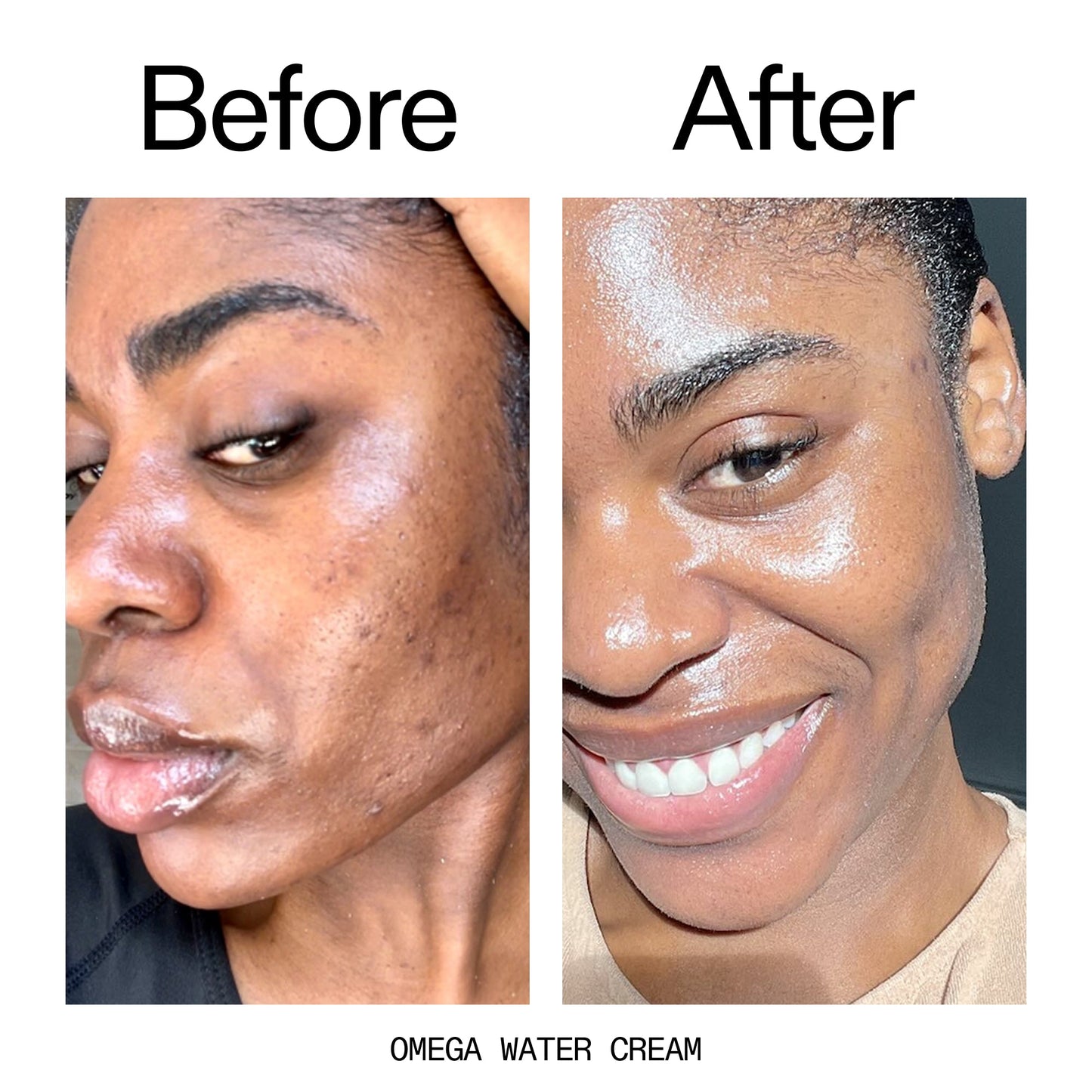 hydrating-cleanser-and-moisturizer-duo-f1 Omega_Water_Cream_Before_After_2000x2000_8e88278b-8c8d-48dc-ac77-4e98ebbd1b77.jpg