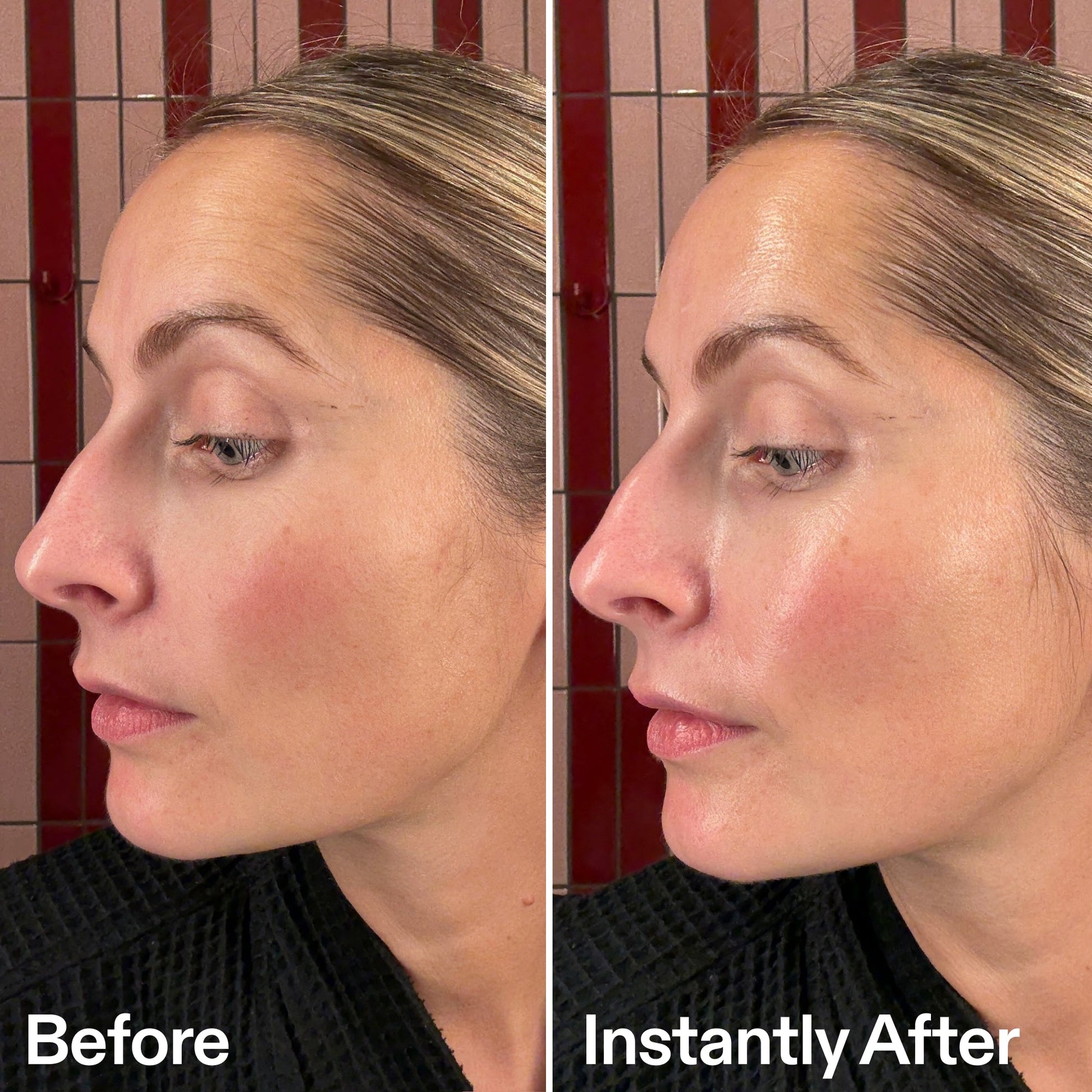 pdrn-serum-b9 07_B_A_PDRN.jpg