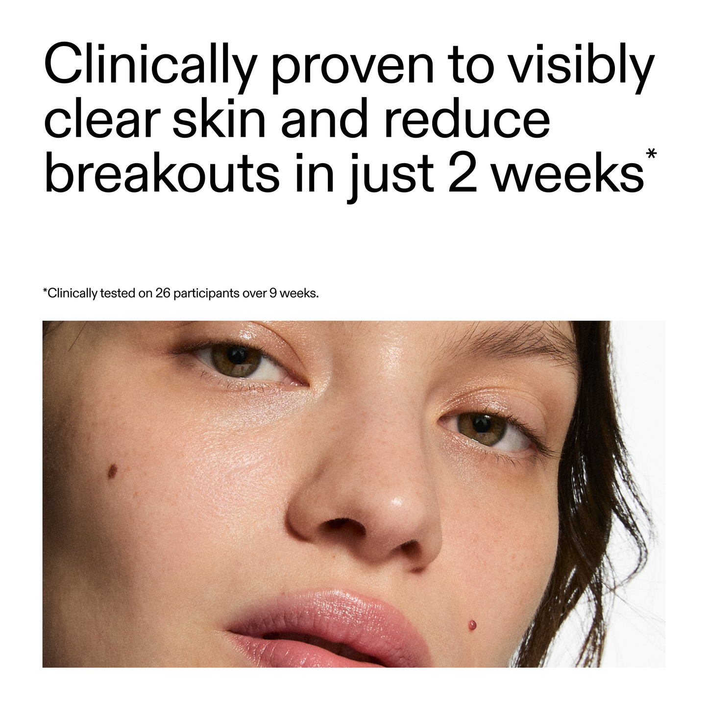 360-acne-clearing-duo-g3 360_Serum_Key_Claim.png