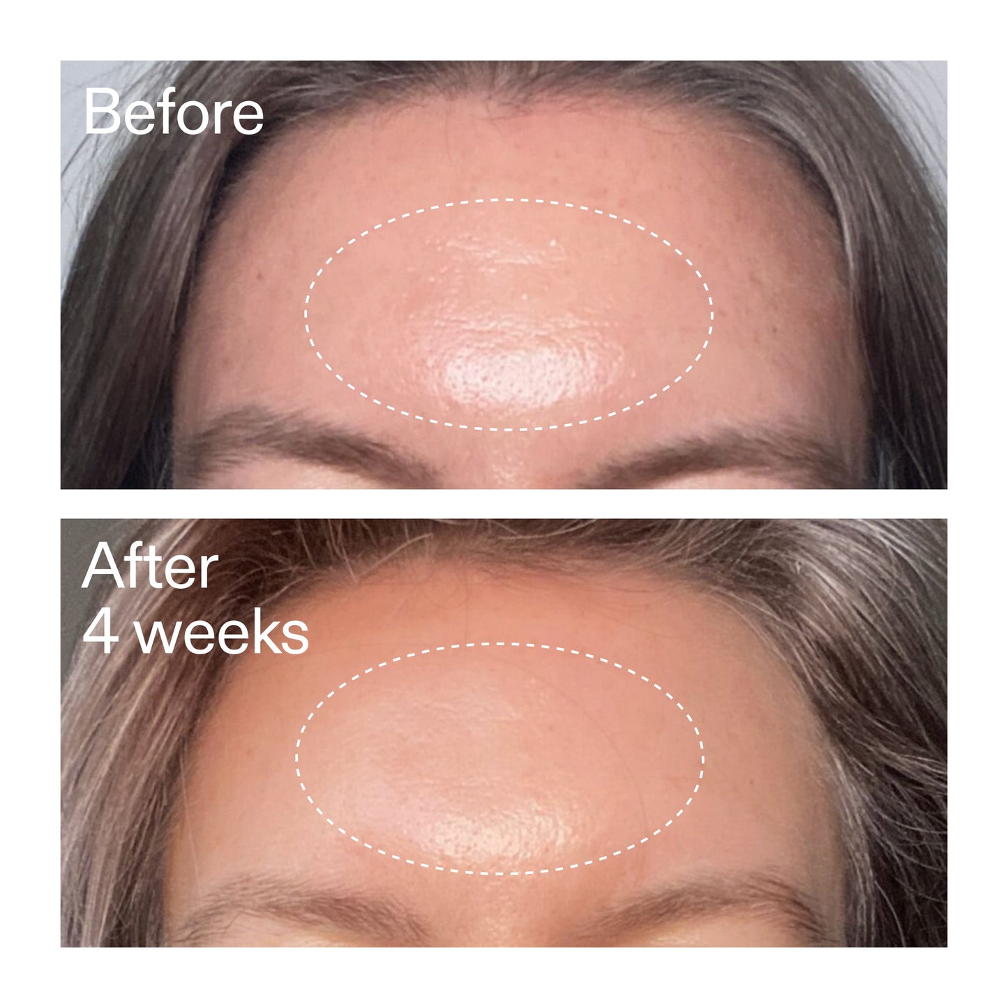 advanced-0-2-retinal-serum-duo-e2 AdvancedRetinal_BeforeAfter1_2000x2000_4e9c798a-f30e-45b8-a34a-7c4740f2f2cb.jpg