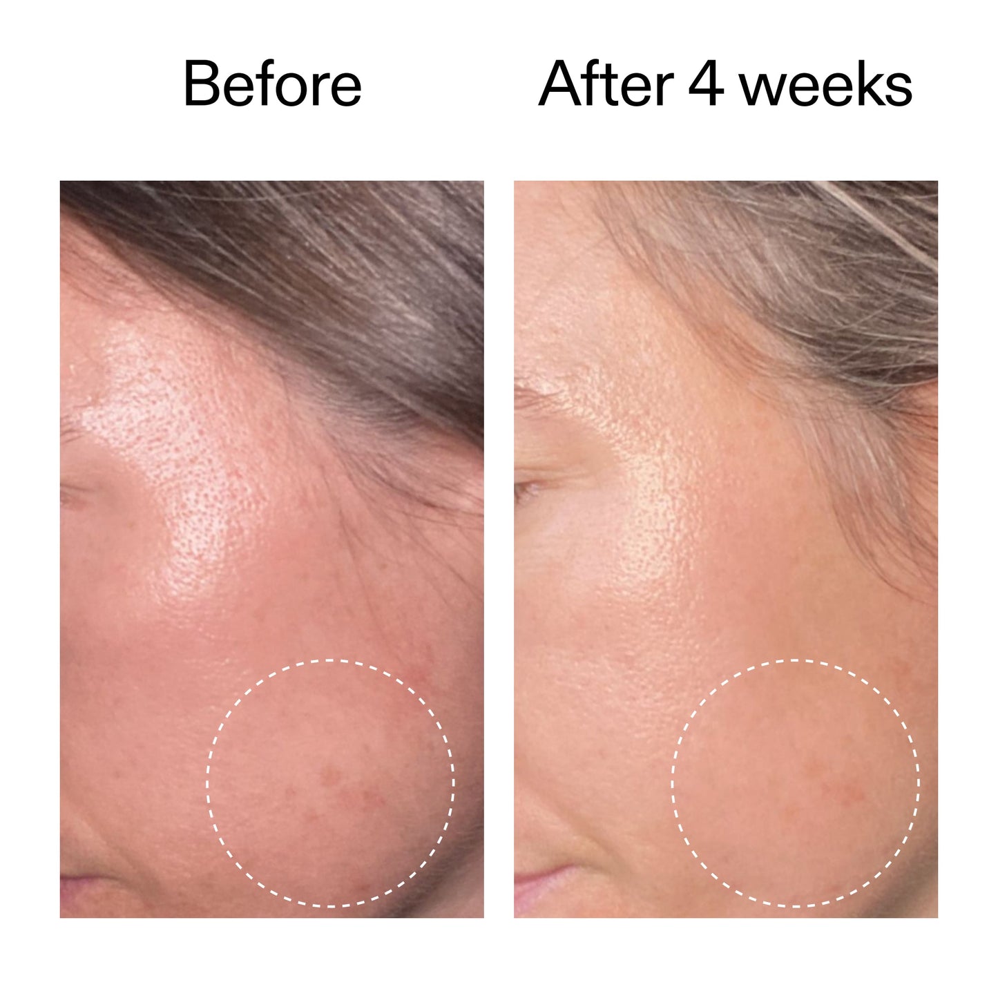 advanced-0-2-retinal-serum-duo-e2 AdvancedRetinal_BeforeAfter2__2000x2000_8ef75542-2316-4814-81ee-0f66a85912bc.jpg