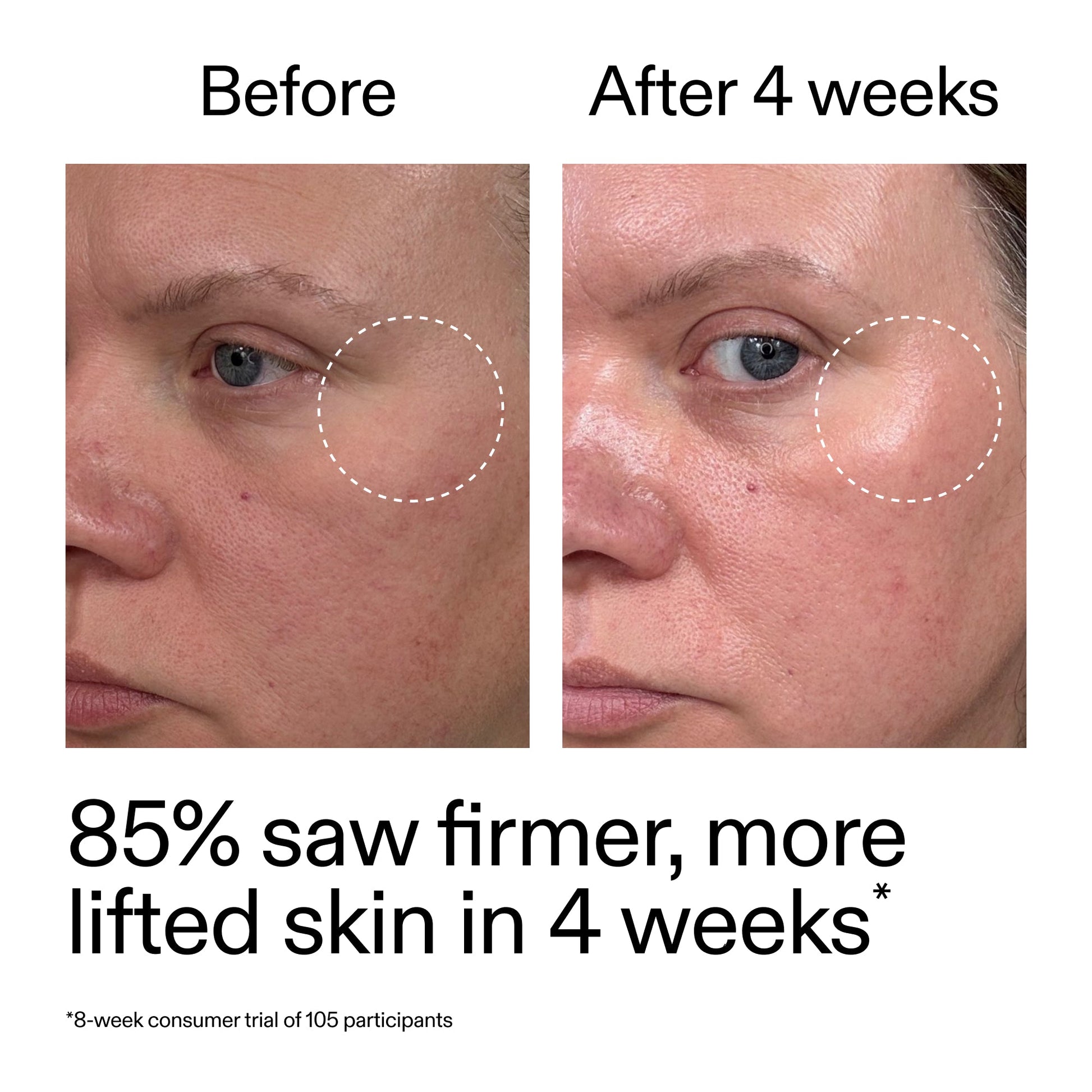 advanced-0-2-retinal-serum-duo-e2 AdvancedRetinal_BeforeAfter_Claim1_2000x2000_3a315aa8-f408-4b33-bbeb-0d9209f98404.jpg