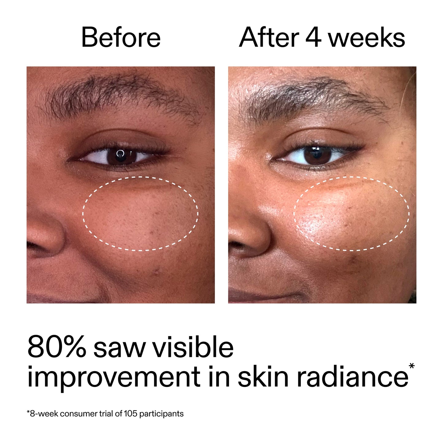advanced-0-2-retinal-serum-duo-e2 AdvancedRetinal_BeforeAfter_Claim2_2000x2000_681b621d-8d44-4d44-9a40-89244f9b2e53.jpg