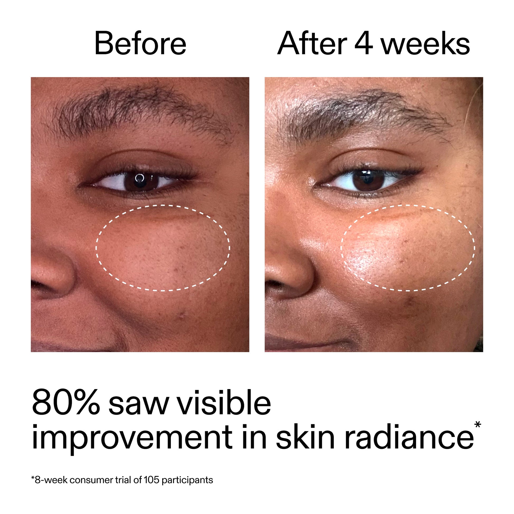 advanced-0-2-retinal-serum-duo-e2 AdvancedRetinal_BeforeAfter_Claim2_2000x2000_681b621d-8d44-4d44-9a40-89244f9b2e53.jpg