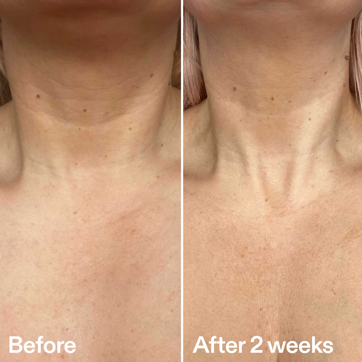 bio-active-neck-lift-stick-n3 B_A_2.jpg