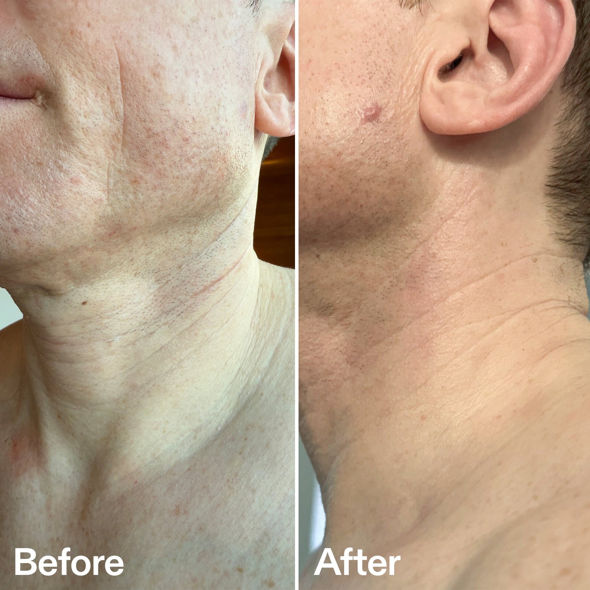 bio-active-neck-lift-stick-n3 B_A_afa2743e-b8e2-4504-92f4-e281cb6cf759.jpg