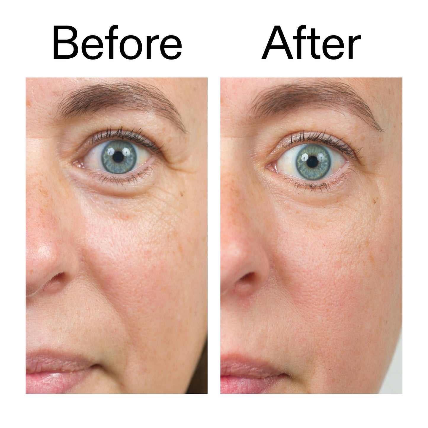 bio-active-ceramide-moisturizer-a9 Bio-Active_Before_After_2000x2000_566e5a9e-135e-417a-8242-b44e5fa35463.jpg