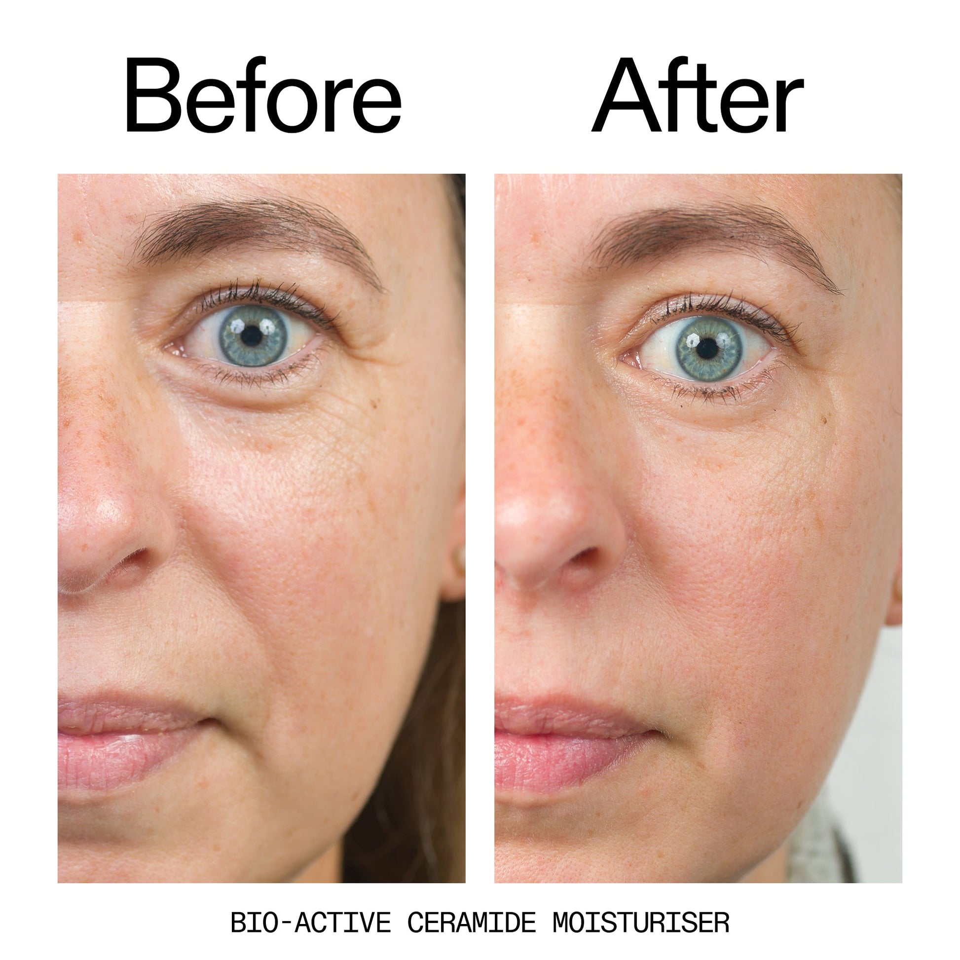 barrier-boosting-trio-e2 Bio-Active_Before_After_2000x2000_600947b4-e8c5-425a-9155-fc15bc83aa12.jpg