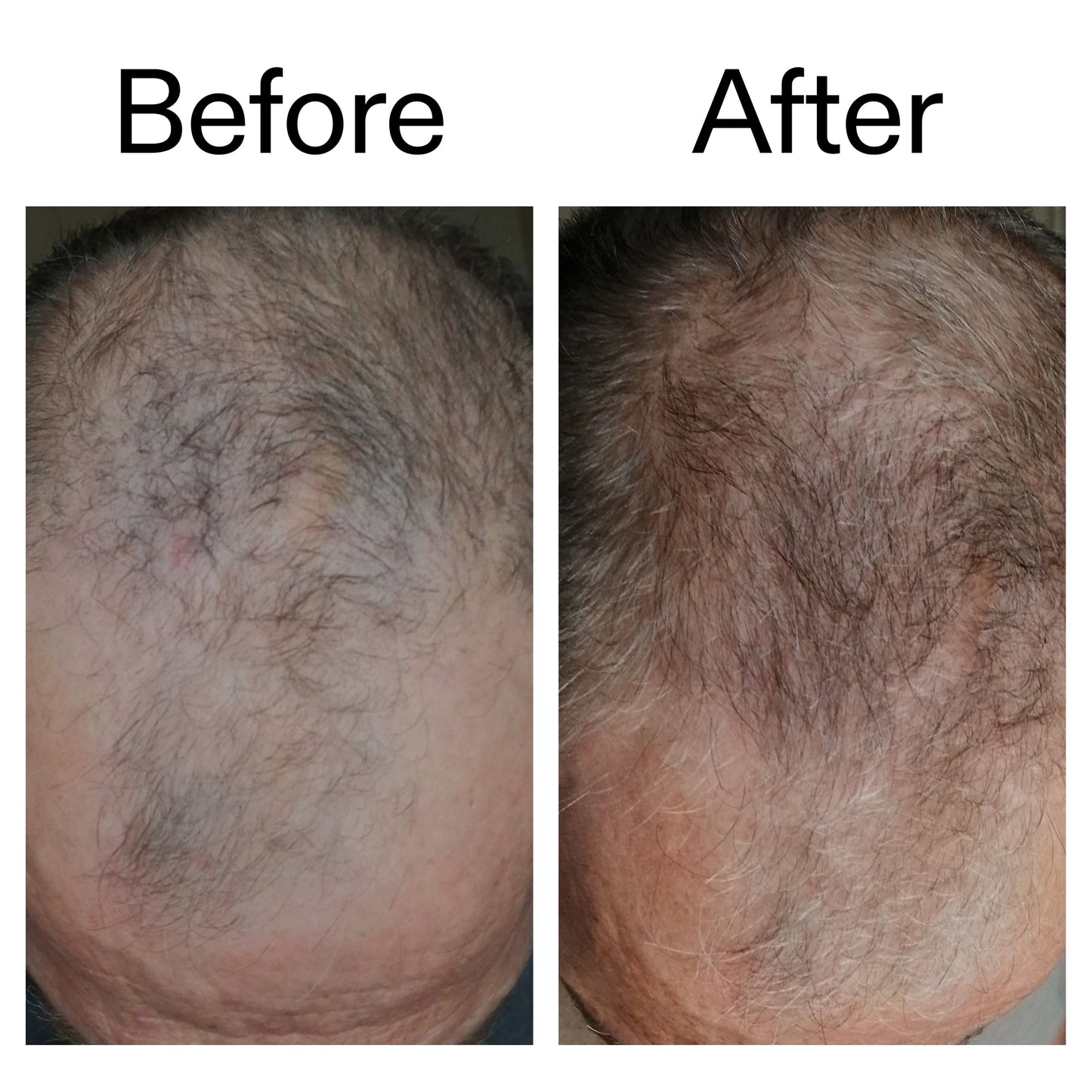 caffeine-stimulating-scalp-treatment-n0 Caffeine_Scalp_Treatment_B_A_Ppage_2000_x_2000.jpg