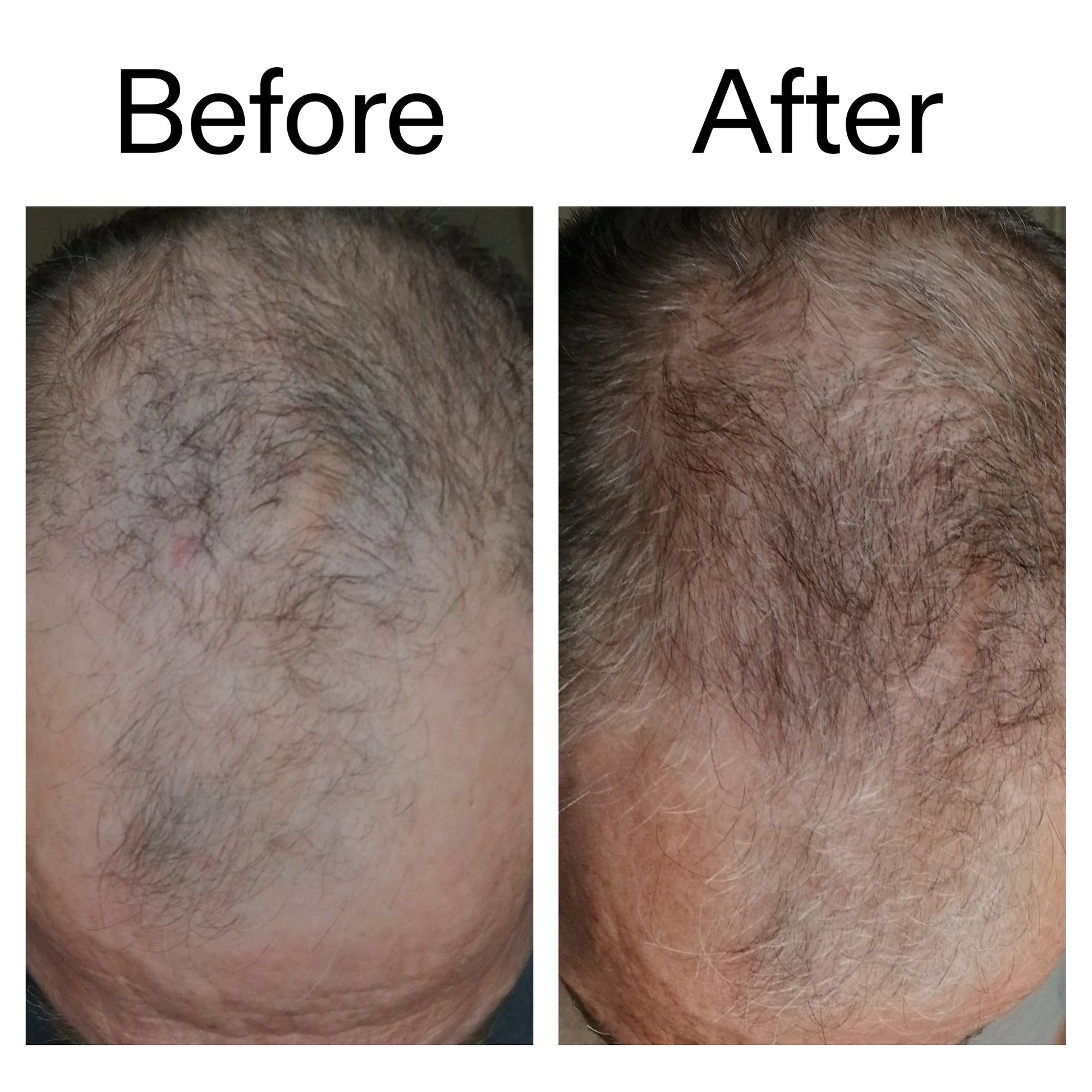 caffeine-stimulating-scalp-treatment-n0 Caffeine_Scalp_Treatment_B_A_Ppage_2000_x_2000.jpg