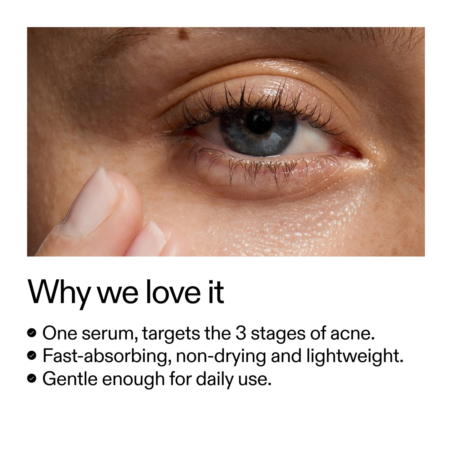 360-acne-clearing-duo-g3 Dioic_Whyweloveit_2000x2000_175aafd3-0cbe-403a-b317-a8362881bfe2.jpg