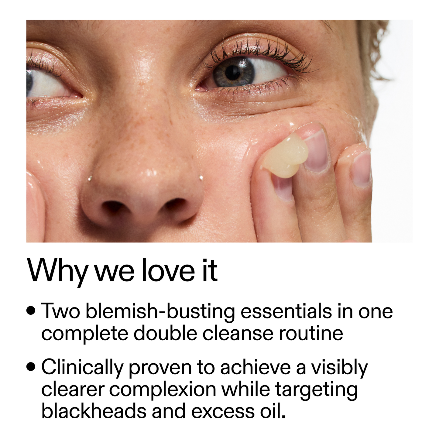 acne-double-cleanse-duo-b7 Double_Cleanse_Duo_for_Breakouts_Why_We_2000x2000_f242cb12-bb5c-487c-b203-071ccb406ec5.png
