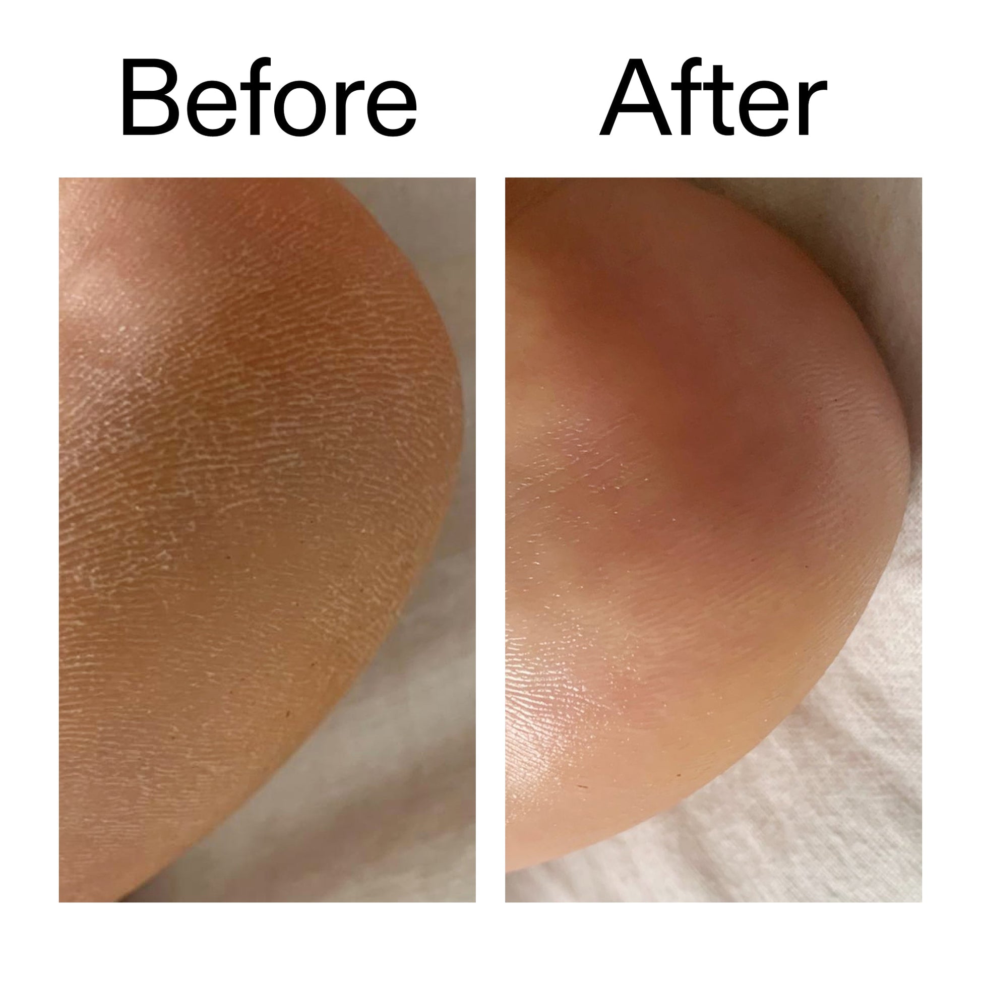 glycolic-acid-exfoliating-body-stick-duo-r4 Glycolic_Acid_Exfoliating_Body_Stick_Before_After_V1_2000x2000_a3043625-9400-429a-a7fb-d6dbd220f722.jpg