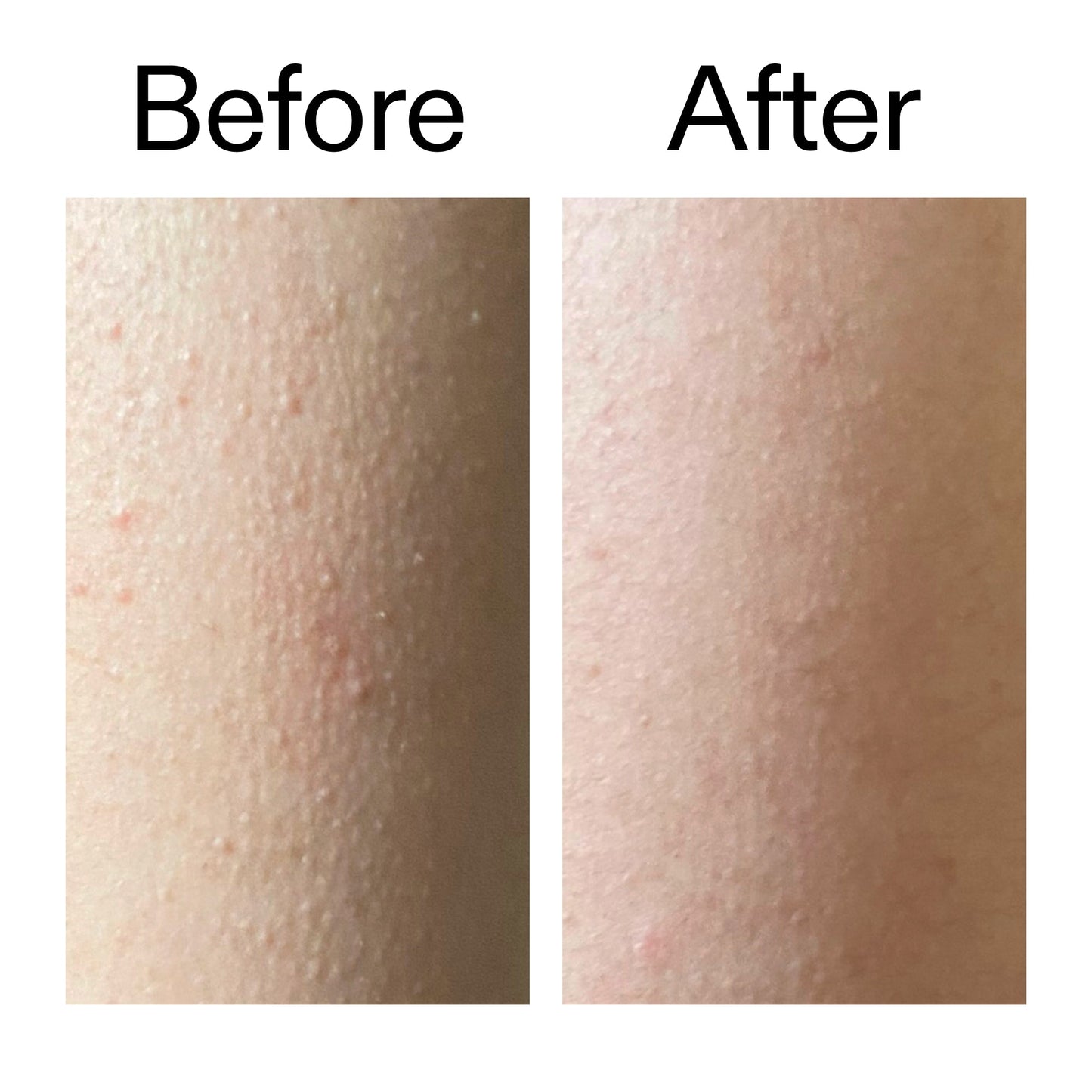 glycolic-acid-exfoliating-body-stick-duo-r4 Glycolic_Acid_Exfoliating_Body_Stick_Before_After_V2_2000x2000_2e4ba052-94f6-4d56-82df-7bdb5b2df7ae.jpg