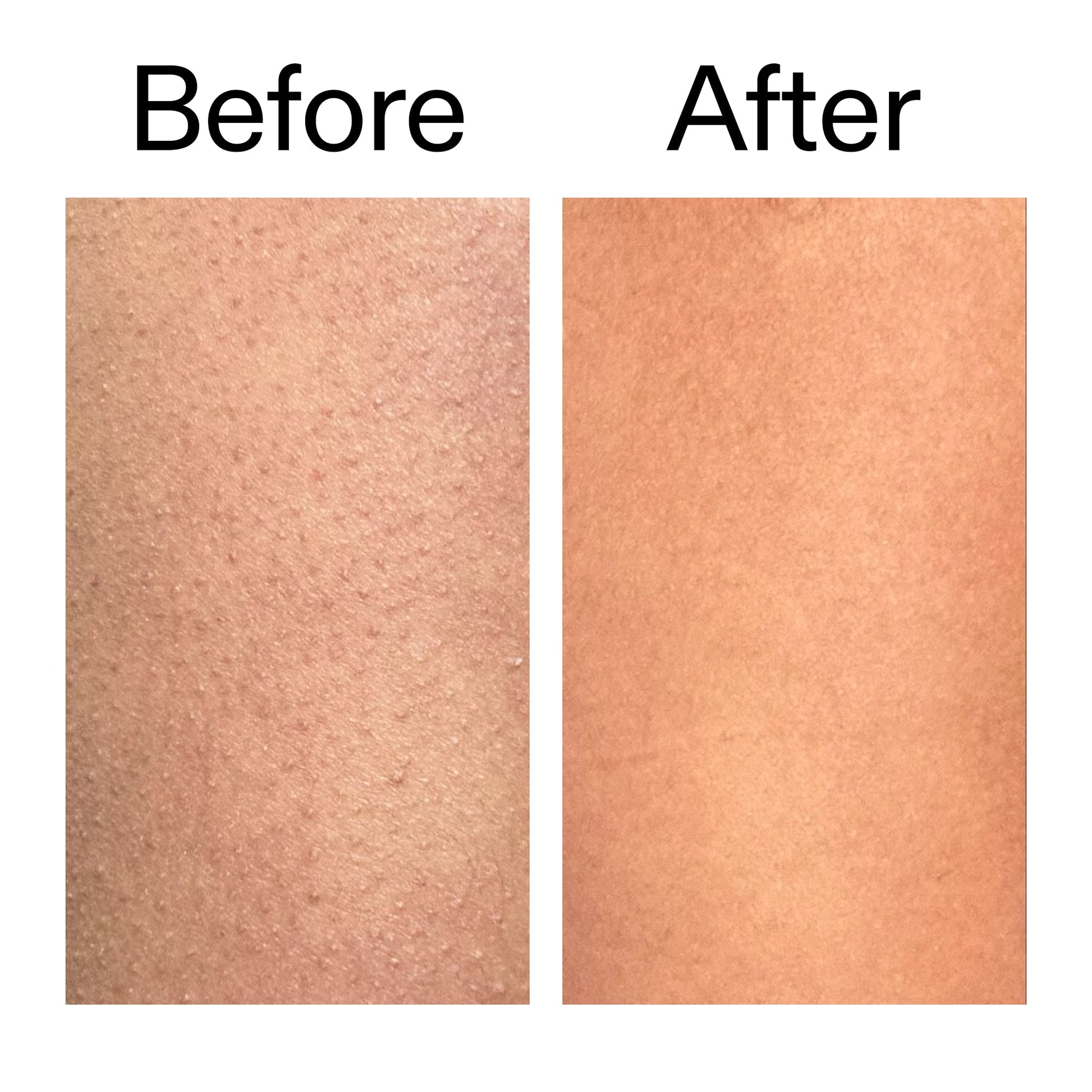 glycolic-acid-exfoliating-body-stick-duo-r4 Glycolic_Body_Stick_B_A_2000x2000_6e6e6b4d-5bd7-43c0-aeed-4d66788e8995.jpg