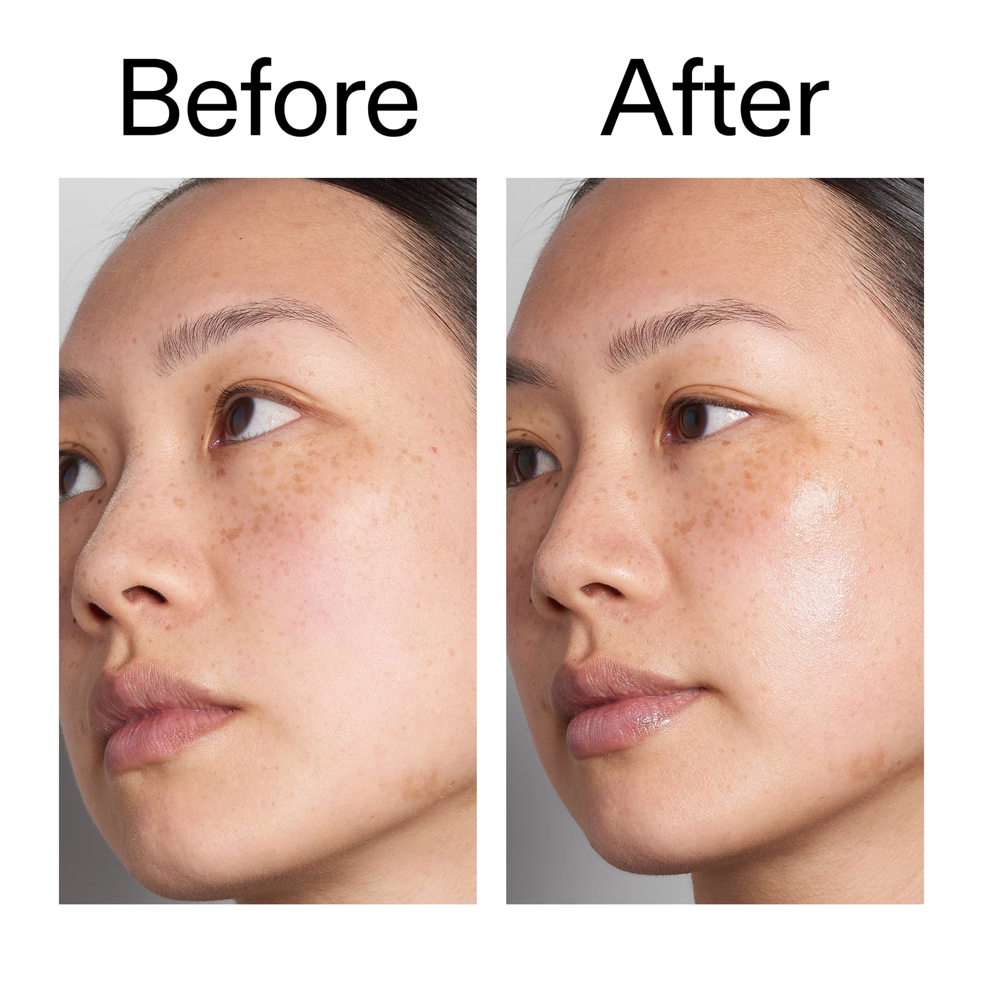 hyaluronic-acid-serum-30ml-f0 Hyaluronic_Acid_Before_After_2000x2000_d7983956-8aa2-4ea3-8255-c63e8d4f892e.jpg