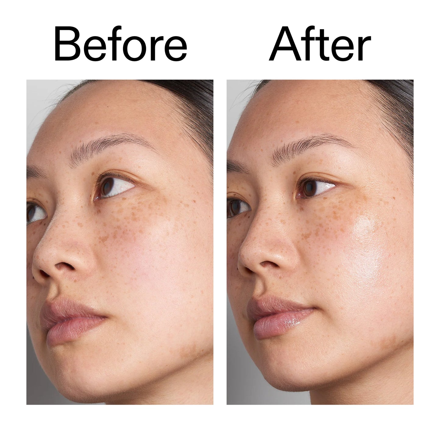 hyaluronic-acid-serum-60ml-duo-p0 Hyaluronic_Acid_Before_After_2000x2000_d566f5ba-a77e-4585-99fd-0f4682b164dd.jpg