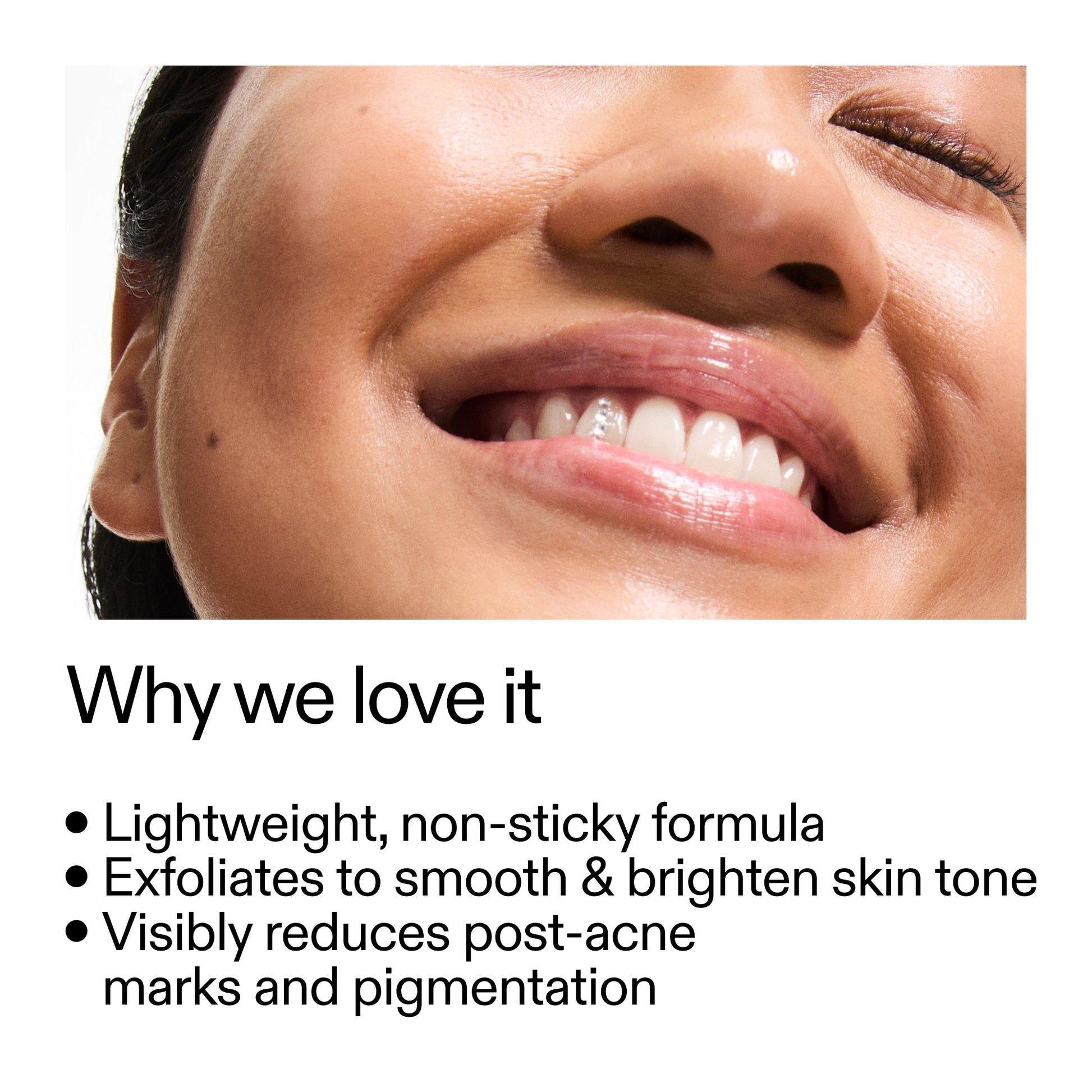 mandelic-acid-treatment-l3 Mandelic_Acid_Treatment_Why_we_love_it_2000x2000_6dfe29a9-2a79-464f-a5e8-e5ac37d93388.jpg