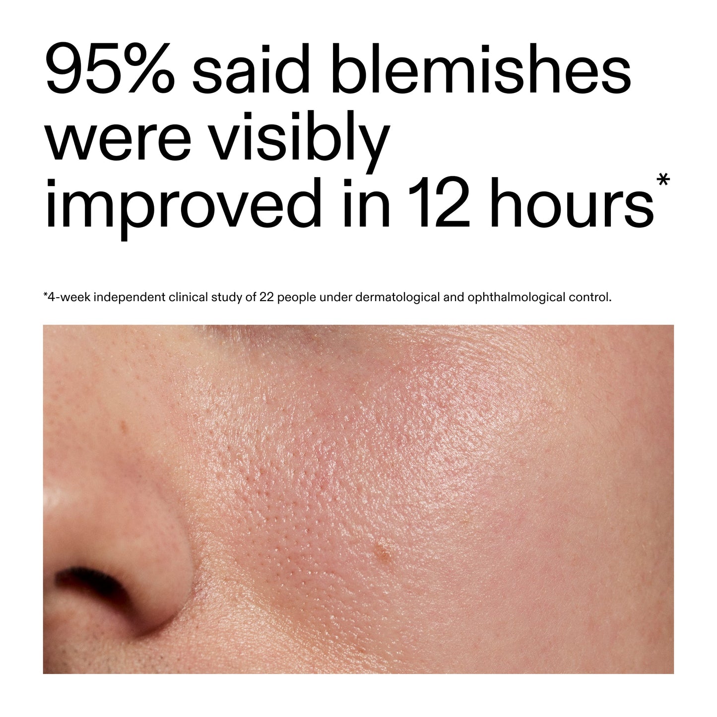 succinic-acid-acne-treatment-z5 Oat_Cleansing_Balm_Claim_2000x2000_ac6ce553-25db-41b2-a981-faae1ac4b8c0.jpg