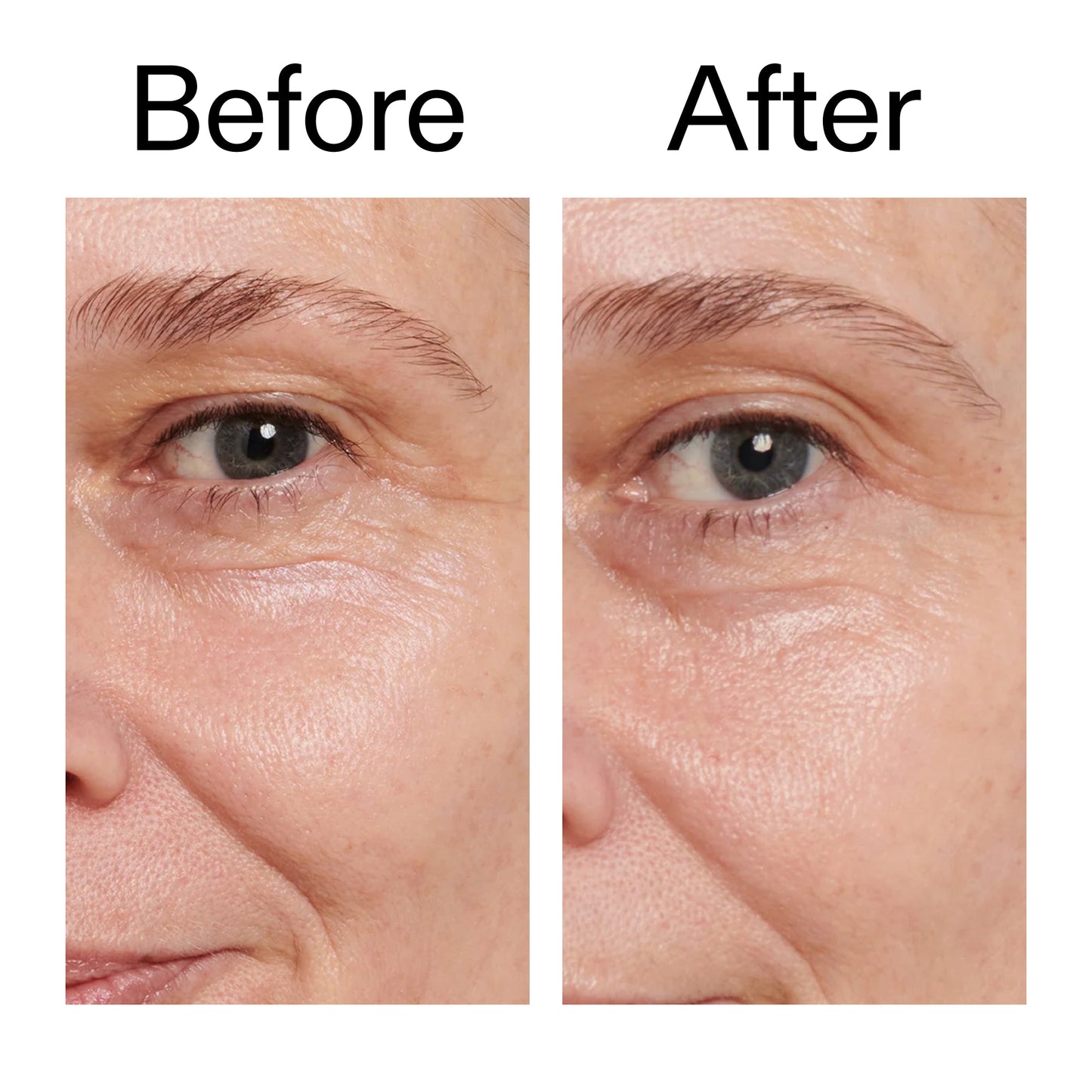 retinol-eye-cream-s8 Retinol_Eye_Cream_Before_After_2000x2000_ac03a80c-109e-4572-a95a-91dc109b4d27.jpg