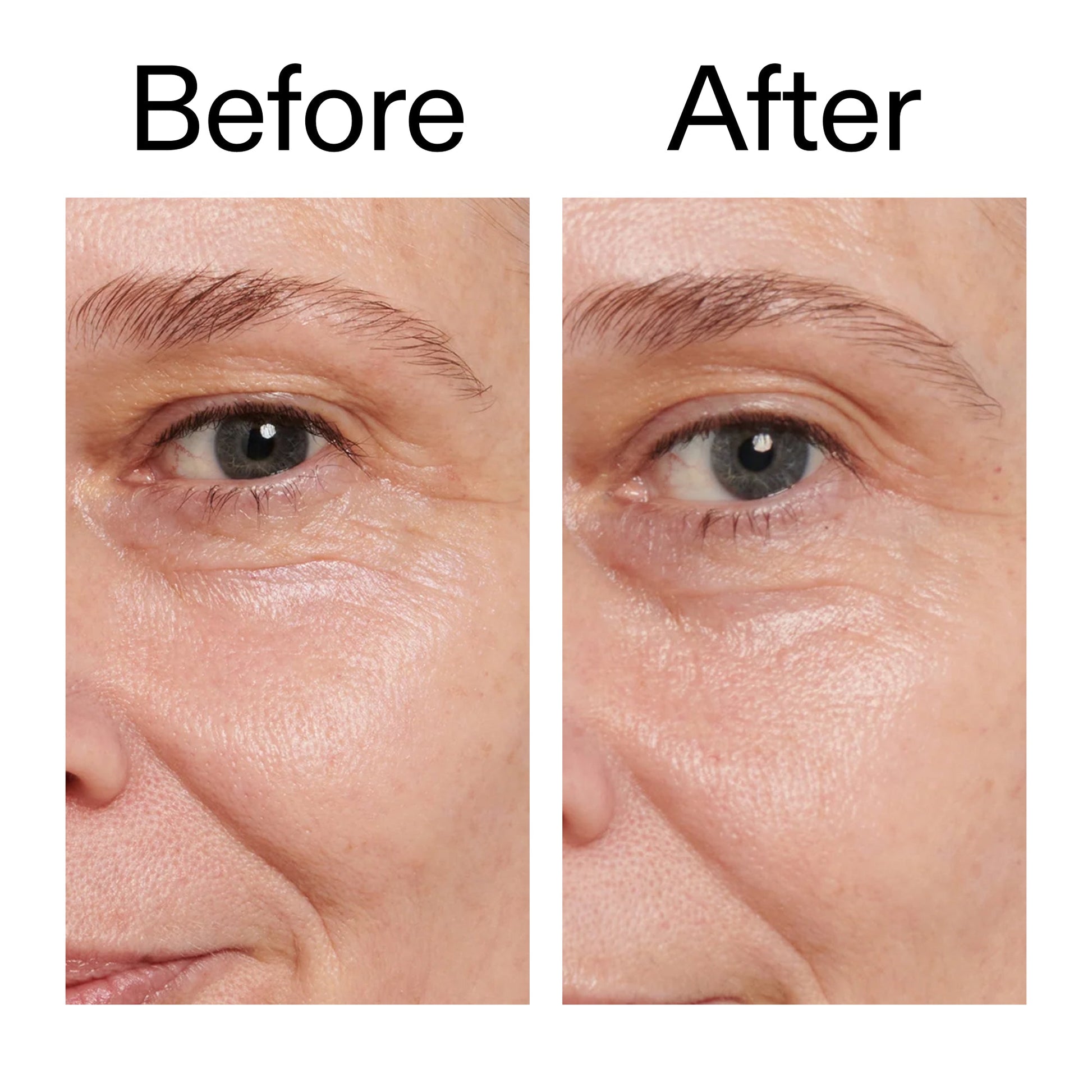 retinol-eye-cream-s8 Retinol_Eye_Cream_Before_After_2000x2000_ac03a80c-109e-4572-a95a-91dc109b4d27.jpg