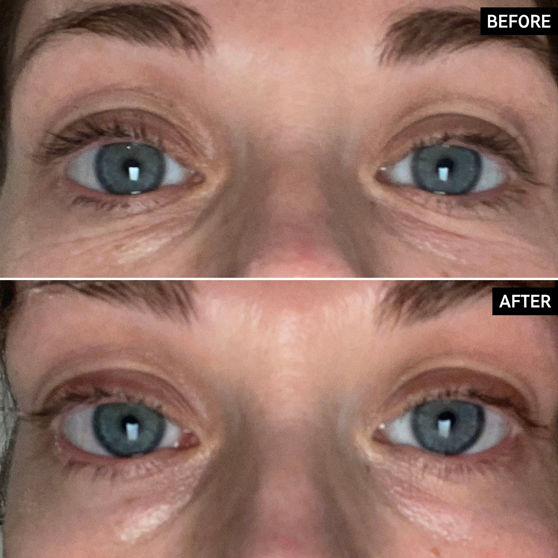 retinol-eye-cream-s8 SITE-UGCBAsApril_Nicole_B_A_PPage_2000x2000_1.jpg