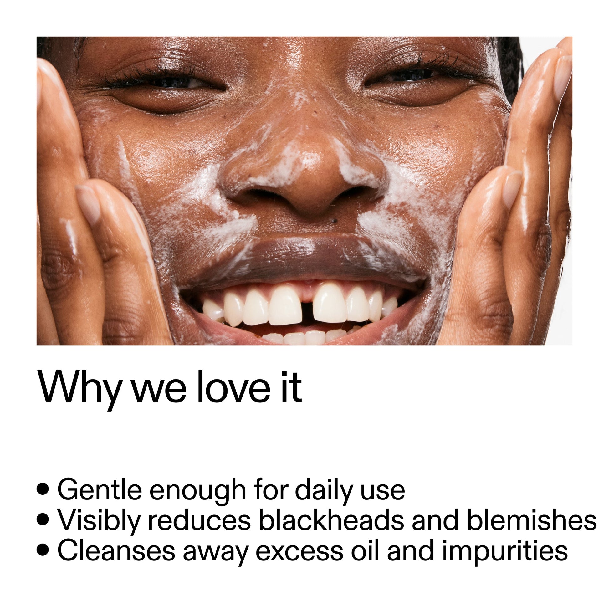 salicylic-acid-cleanser-150ml-c6 Salicylic_Acid_Cleanser_-_300mlWhy_we_love_it_2000x2000_87dc92a9-2559-4309-98cd-4e570f1be735.jpg