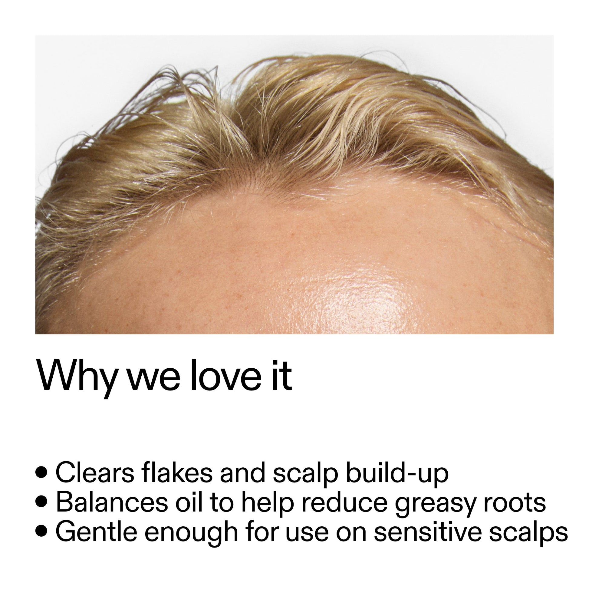 salicylic-acid-exfoliating-scalp-treatment-a9 Salicylic_Acid_Exfoliating_Scalp_Treatment_Why_we_love_it_2000x2000_44b6bd6d-9ec4-4b23-9dc4-bc3fd6f28e14.jpg