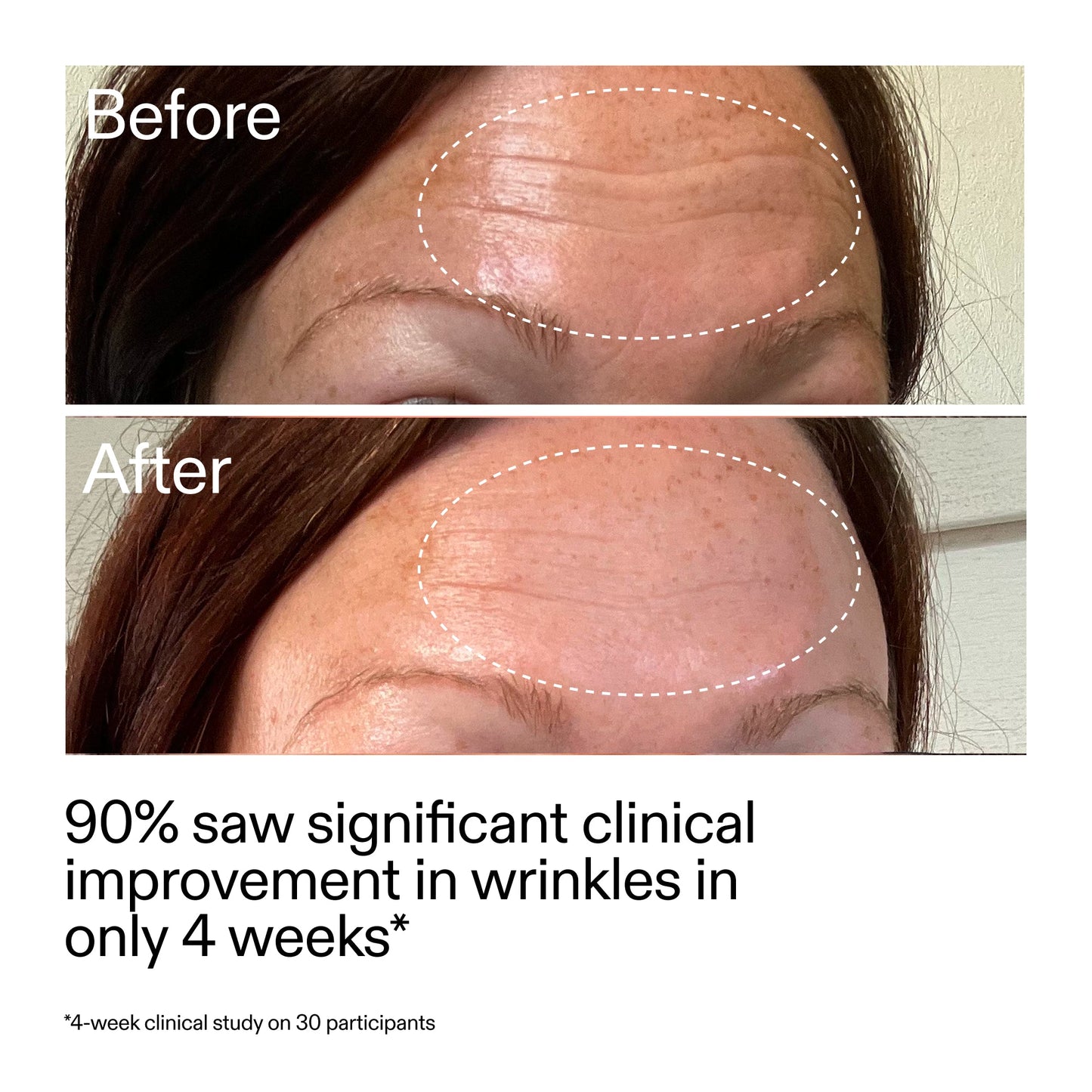starter-retinol-serum-g2 StarterRetinol_BeforeAfter_Claim1_2000x2000_a09b50b6-4688-4527-abae-21bd142b89b7.jpg