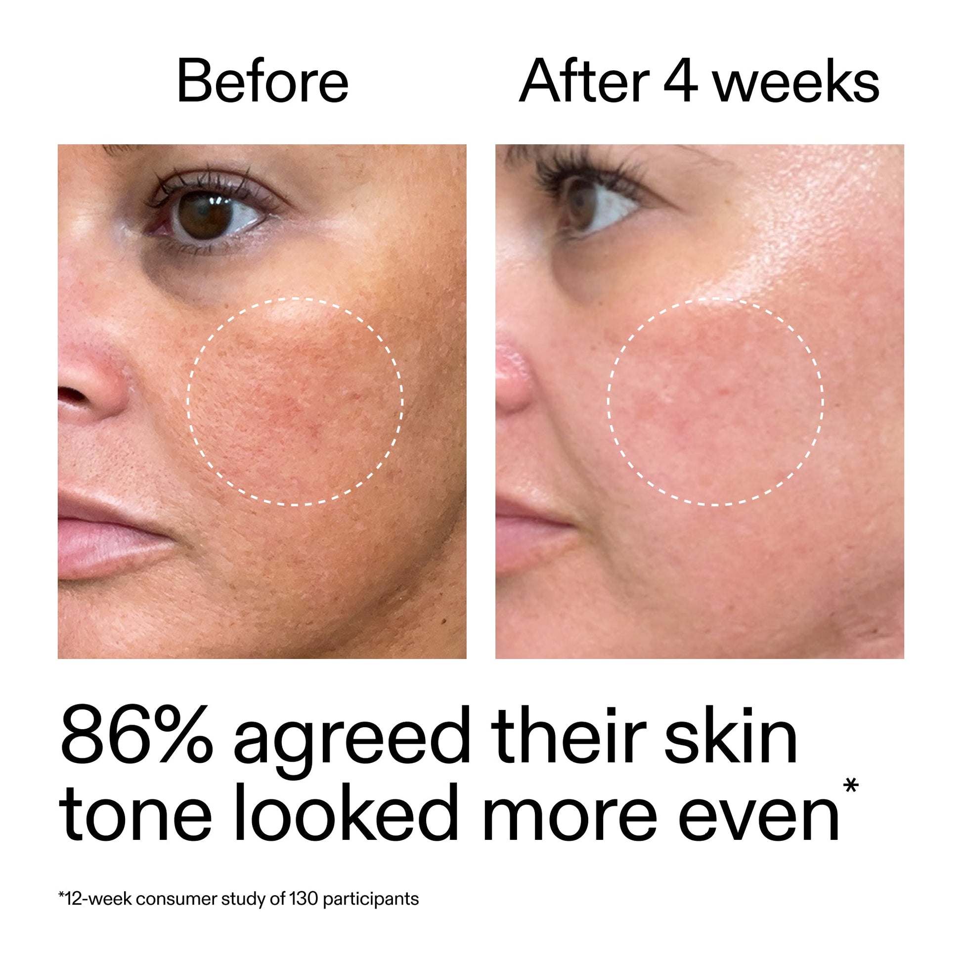 starter-retinol-serum-duo-b2 StarterRetinol_BeforeAfter_Claim2_2000x2000_fc5bb8ac-8588-478f-98d5-28af6651601a.jpg