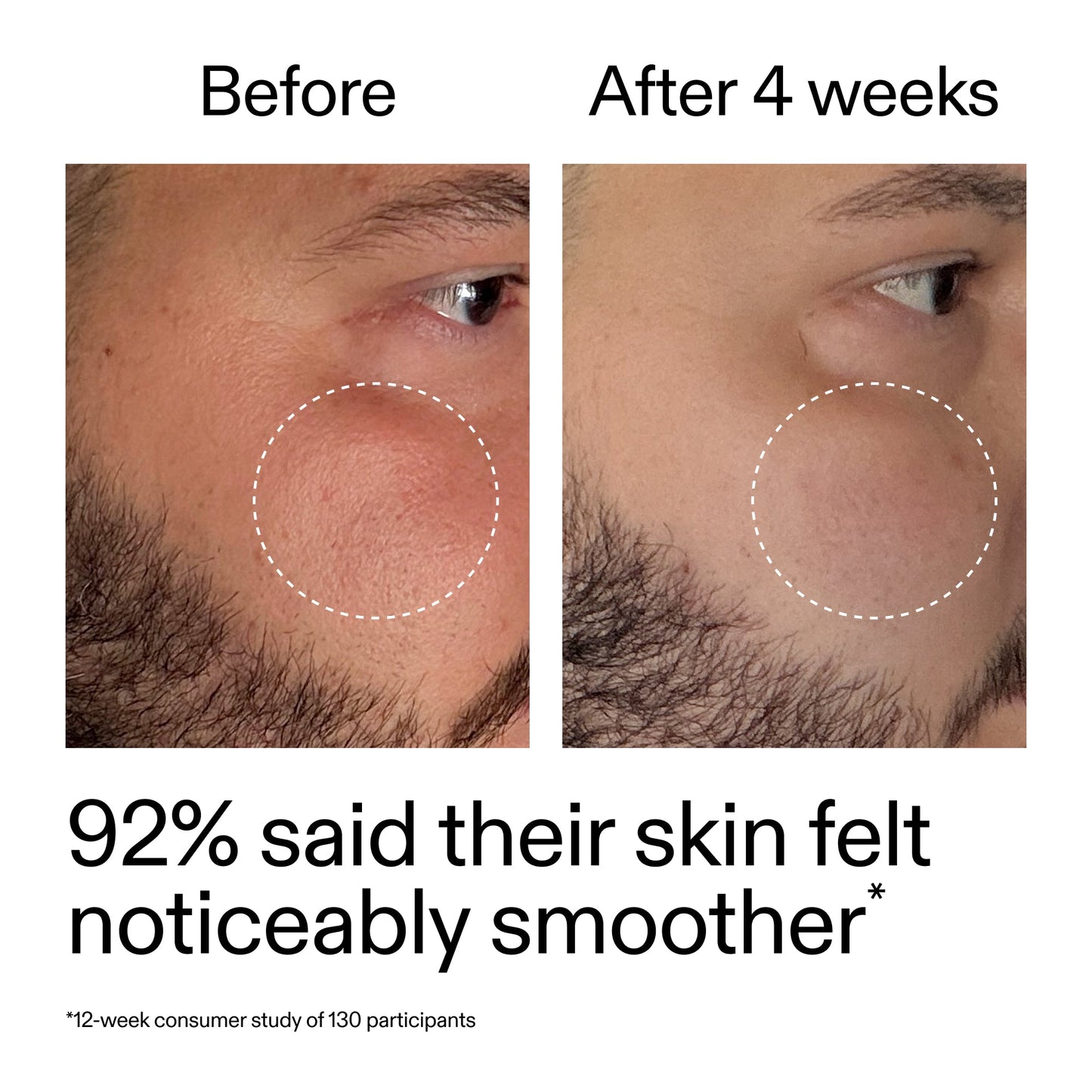 starter-retinol-serum-duo-b2 StarterRetinol_BeforeAfter_Claim3_2000x2000_458243a8-bbb0-4e5d-a274-29c7766d339b.jpg