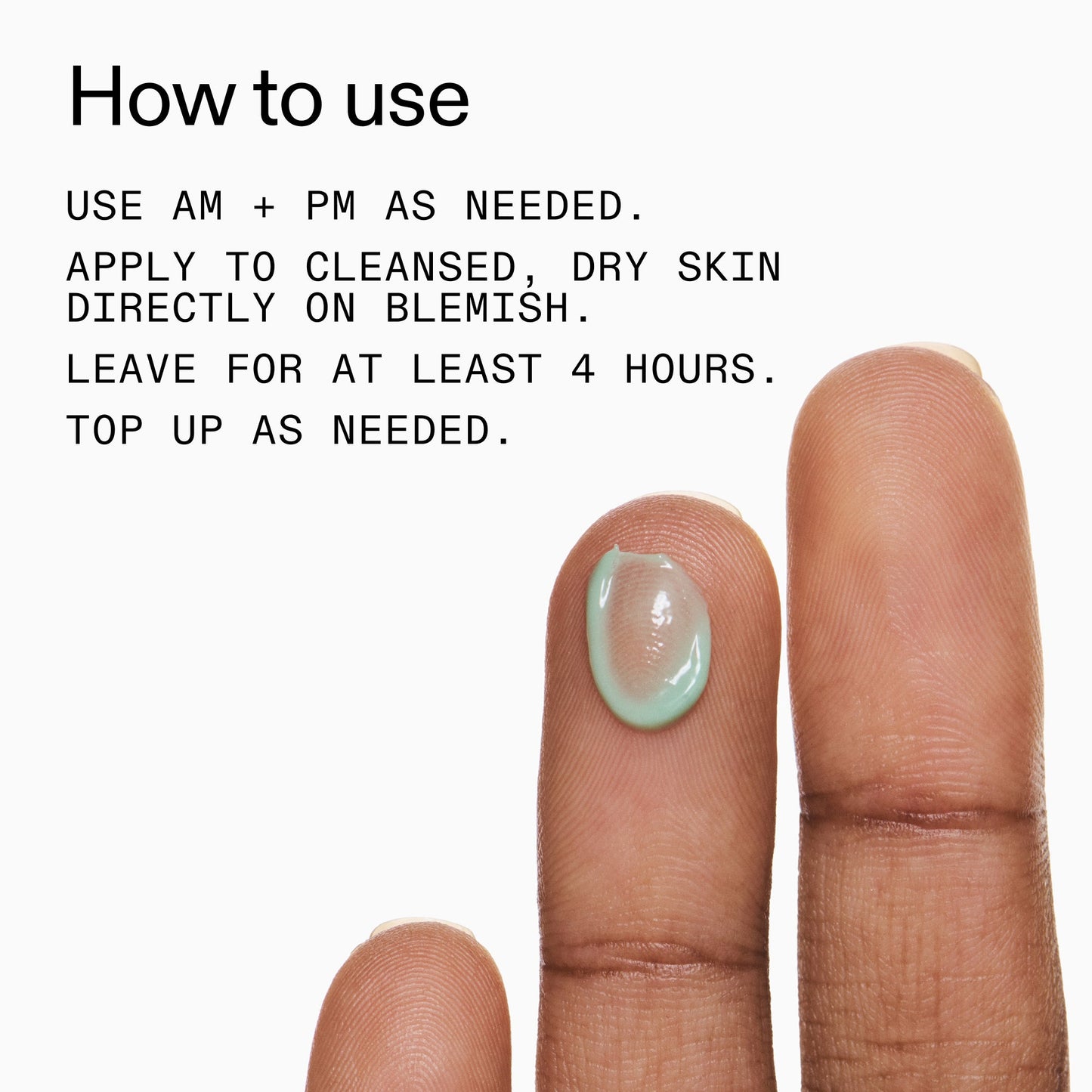 succinic-acid-acne-treatment-z5 Succinic_Acid_Treatment_How_to_Use_2000x2000_d57137d5-d7f1-427c-9a46-5fc00c19c542.jpg
