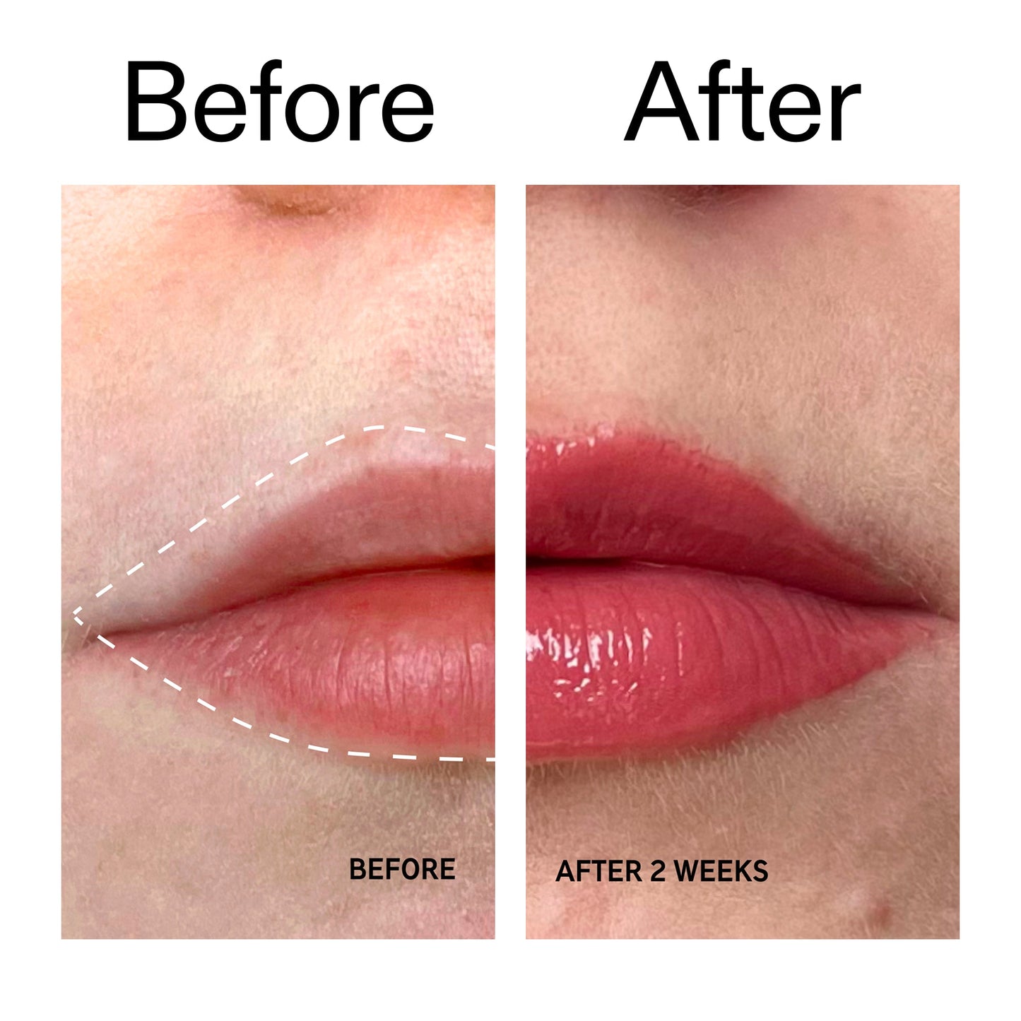 tripeptide-plumping-berry-lip-balm-p3 Tripeptide_Plumping_Lip_Balm_-_Berry_Before_After_2000x2000_9474bbd8-43ca-4b0e-b0e7-dfab70b91927.jpg