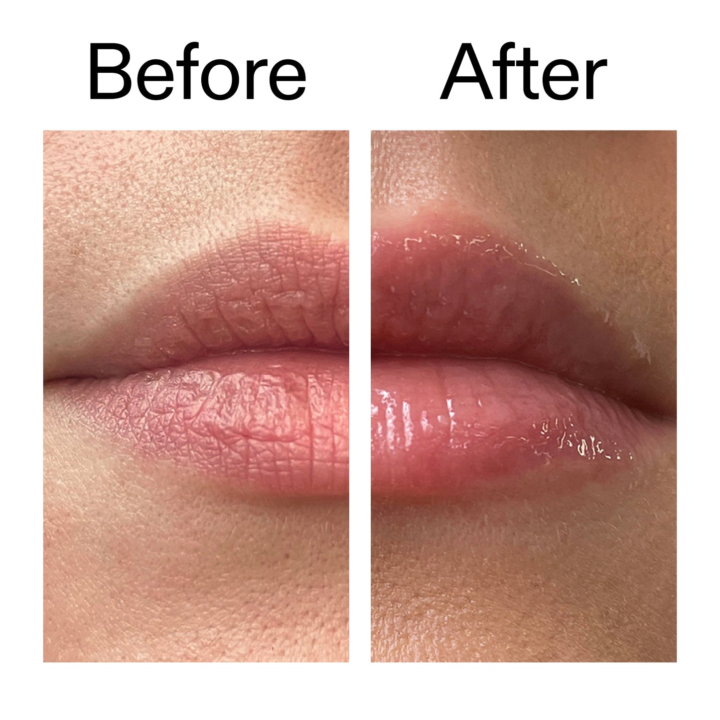 tripeptide-plumping-lip-balm-s2 Tripeptide_Plumping_Lip_Balm_Before_After_2000x2000_b4a5ee04-d2ac-4857-8f01-17209acc4bf3.jpg