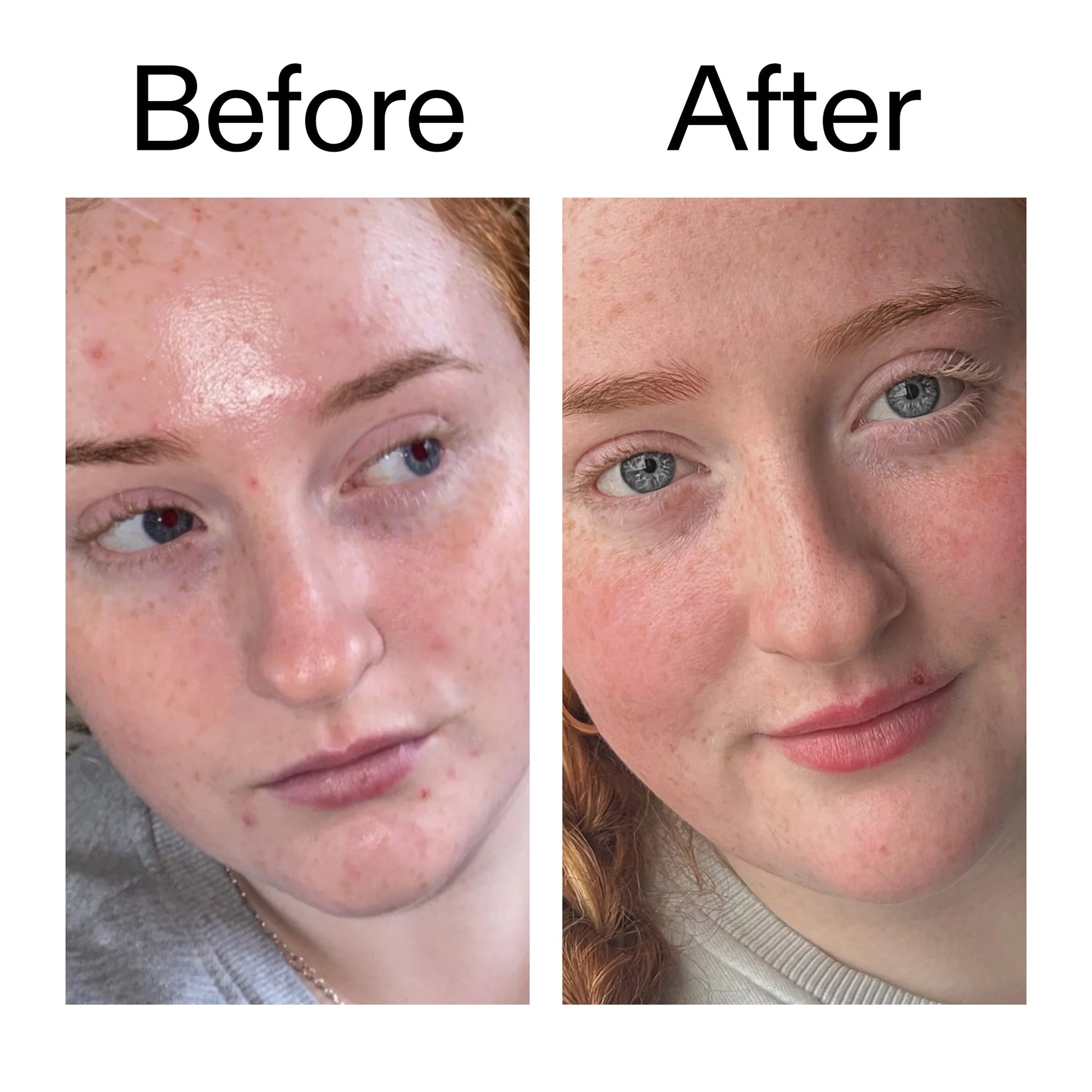vitamin-b-c-and-e-moisturizer-z4 Vitamin_B_C_and_E_Moisturizer_Before_After_2000x2000_b0781a76-5ad2-4be9-95b8-ef92b356833c.jpg